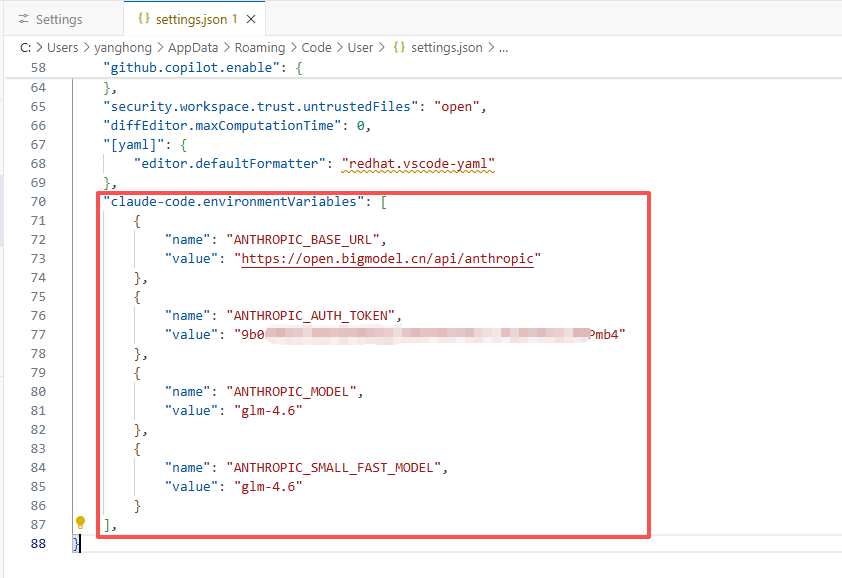 VS Code settings.json 配置示例